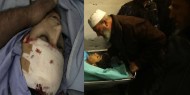 شهيدان خلال مواجهات مع الاحتلال بالبريج ونابلس